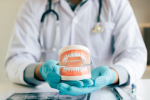 dentist holding dentures in office room M76FVXQ