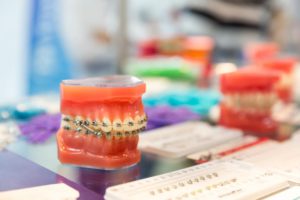 dental-medicine-equipment-orthodontic-2021-04-02-20-15-48-utc (1)