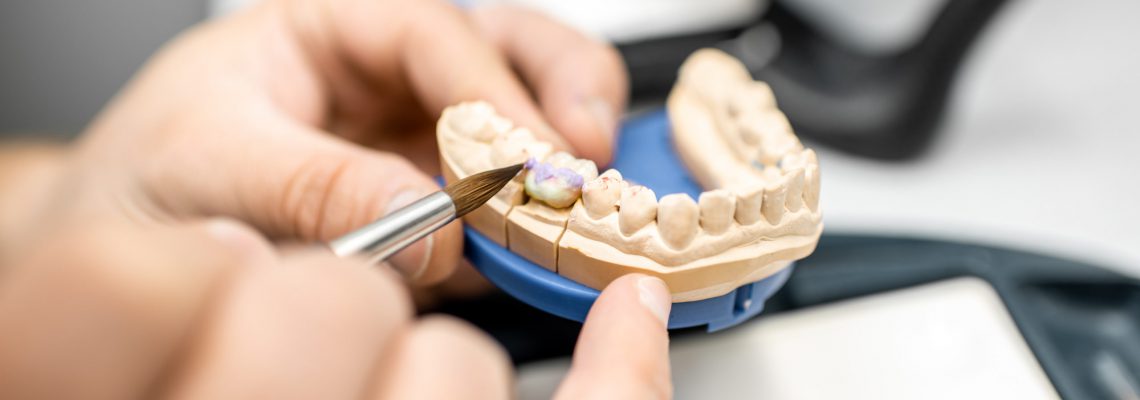 Dental technician coloring dental prosthesis with a paint brush at the laboratory, close-up view. Concept of implantats producing